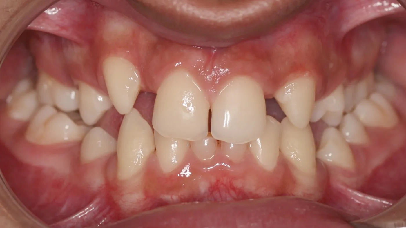 Before treatment: Other results