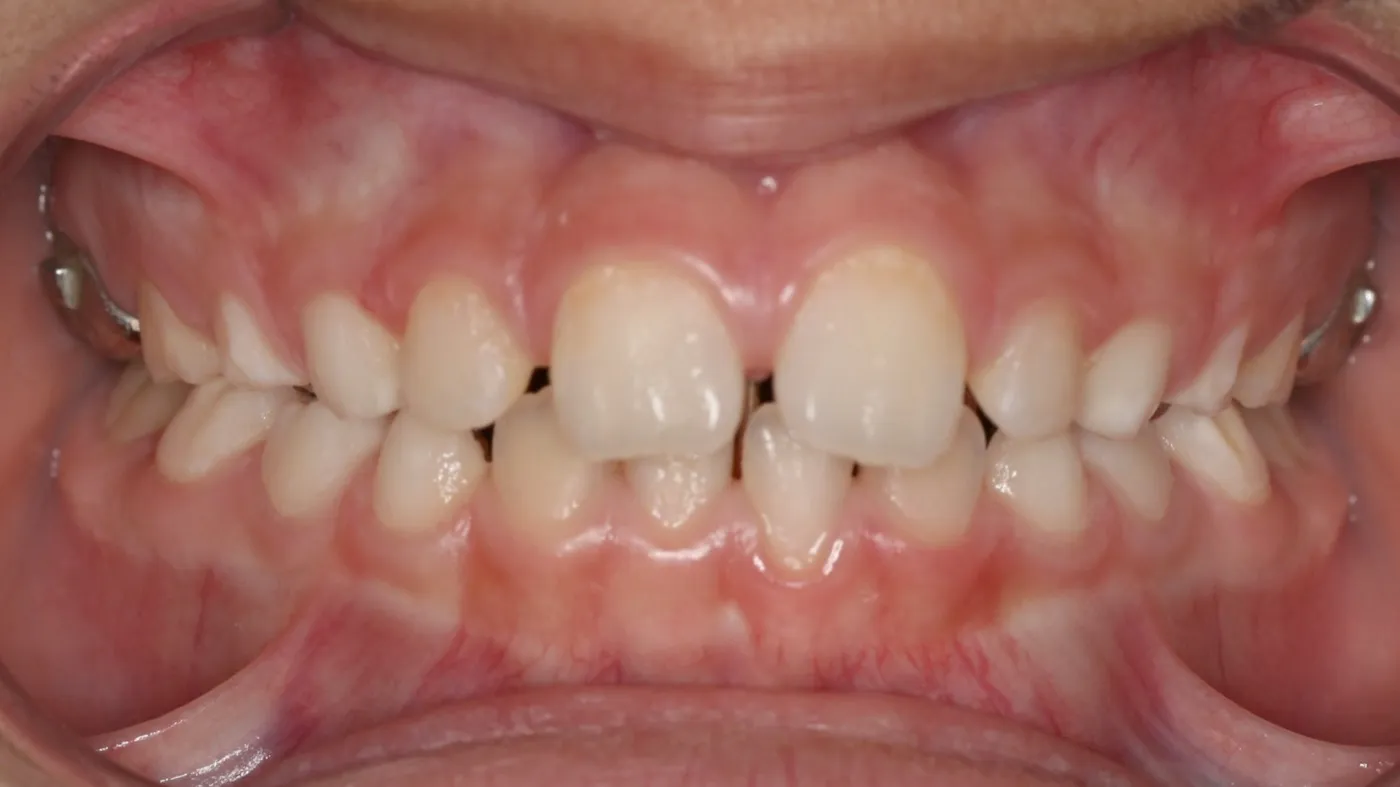 After treatment: Other results