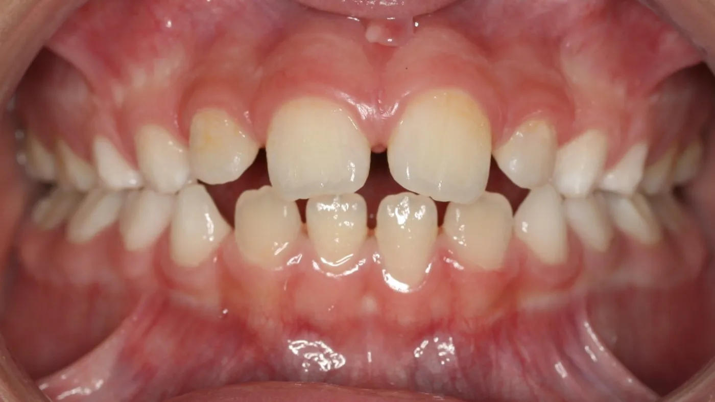 Before treatment: Other results